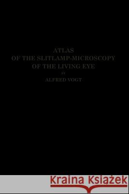 Atlas of the Slitlamp-Microscopy of the Living Eye: Technic and Methods of Examination Vogt, Alfred 9783662245323 Springer
