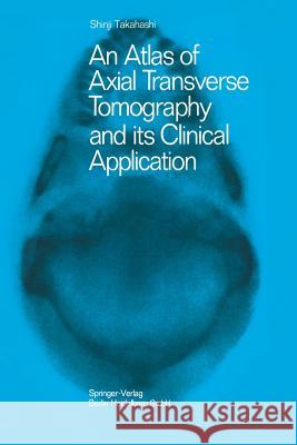 An Atlas of Axial Transverse Tomography and Its Clinical Application Shinji Takahashi Shinji Takahashi 9783662245736 Springer