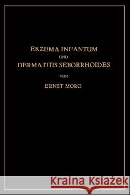 Ekzema Infantum Und Dermatitis Seborrhoides: Klinik Und Pathogenese Moro, Ernst 9783662273173 Springer