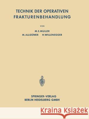 Technik Der Operativen Frakturenbehandlung Müller, Maurice Edmond 9783662281833 Springer