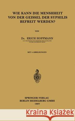 Wie Kann Die Menschheit Von Der Geissel Der Syphilis Befreit Werden? Hoffmann, Erich 9783662312896 Springer