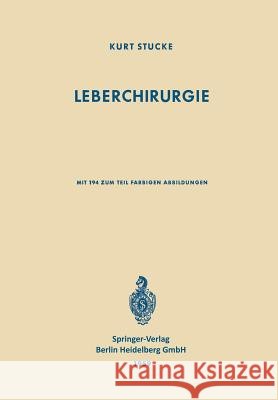 Leberchirurgie: Grundlagen - Grenzen - Möglichkeiten Stucke, K. 9783662353462 Springer