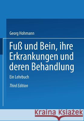 Fuß Und Bein Ihre Erkrankungen Und Deren Behandlung: Ein Lehrbuch Hohmann, Georg 9783662404898 Springer