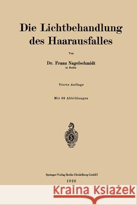 Die Lichtbehandlung Des Haarausfalles Franz Nagelschmidt 9783662408995 Springer