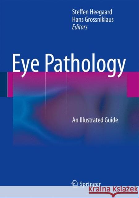 Eye Pathology: An Illustrated Guide Heegaard, Steffen 9783662433812 Springer