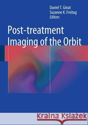 Post-treatment Imaging of the Orbit Daniel Thomas Ginat, Suzanne K. Freitag 9783662440223