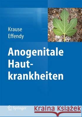 Anogenitale Hautkrankheiten: Erkennen, Befunden, Behandeln Krause, Walter 9783662453308 Springer