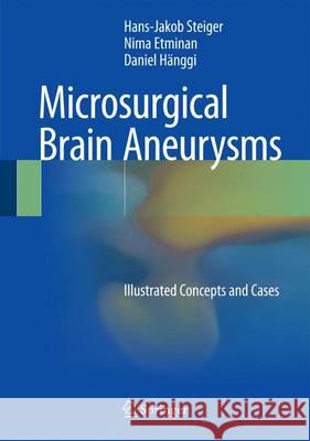 Microsurgical Brain Aneurysms: Illustrated Concepts and Cases Steiger, Hans-Jakob 9783662456781 Springer