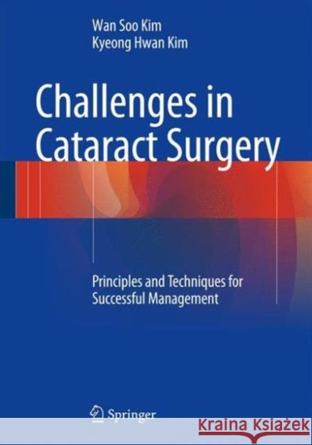 Challenges in Cataract Surgery: Principles and Techniques for Successful Management Kim, Wan Soo 9783662460917 Springer