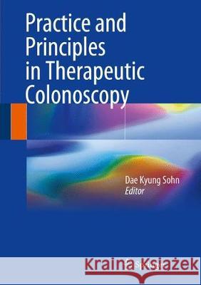 Practice and Principles in Therapeutic Colonoscopy Dae Kyung Sohn 9783662465516 Springer