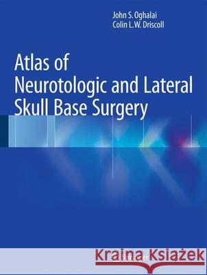 Atlas of Neurotologic and Lateral Skull Base Surgery John S. Oghalai Colin L. W. Driscoll 9783662466933