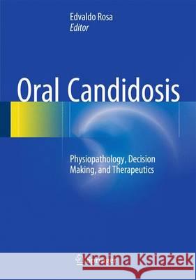 Oral Candidosis: Physiopathology, Decision Making, and Therapeutics Ribeiro, Edvaldo Antonio 9783662471937