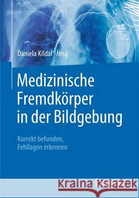 Medizinische Fremdkörper in Der Bildgebung: Thorax, Abdomen, Gefäße Und Kinder Kildal, Daniela 9783662472958