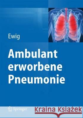 Ambulant Erworbene Pneumonie Ewig, Santiago 9783662473115 Springer