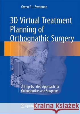 3D Virtual Treatment Planning of Orthognathic Surgery: A Step-By-Step Approach for Orthodontists and Surgeons Swennen, Gwen 9783662473887 Springer