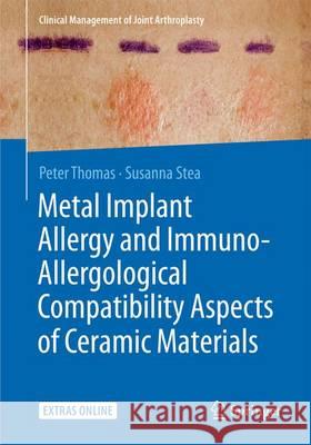 Metal Implant Allergy and Immuno-Allergological Compatibility Aspects of Ceramic Materials Peter Thomas 9783662474396