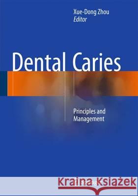 Dental Caries: Principles and Management Xuedong, Zhou 9783662474495 Springer