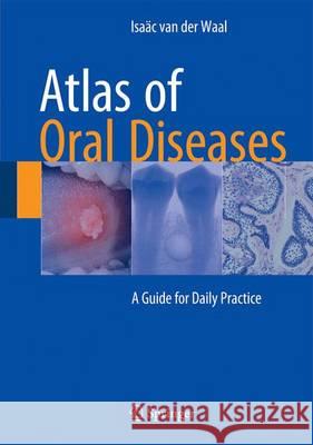 Atlas of Oral Diseases: A Guide for Daily Practice Van Der Waal, Isaäc 9783662481219 Springer