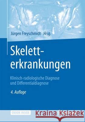 Skeletterkrankungen: Klinisch-Radiologische Diagnose Und Differentialdiagnose Freyschmidt, Jürgen 9783662481363 Springer