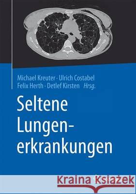 Seltene Lungenerkrankungen Michael Kreuter Ulrich Costabel Felix Herth 9783662484180