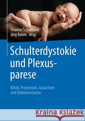 Schulterdystokie Und Plexusparese: Klinik, Prävention, Gutachten Und Dokumentation Schwenzer, Thomas 9783662487860 Springer