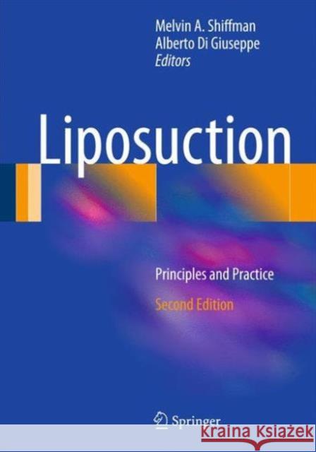 Liposuction: Principles and Practice Shiffman, Melvin a. 9783662489017 Springer