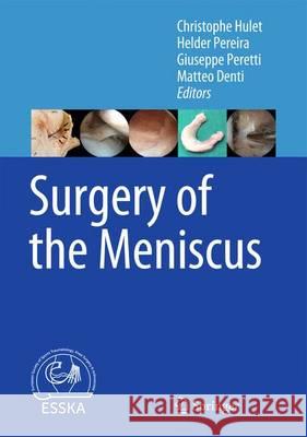 Surgery of the Meniscus Christophe Hulet Helder Pereira Giuseppe Peretti 9783662491867 Springer