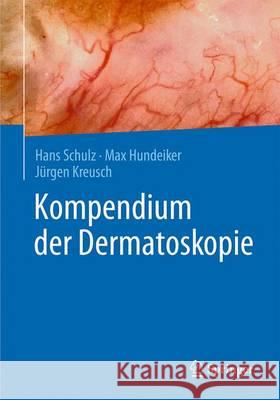Kompendium Der Dermatoskopie Schulz, Hans 9783662494905