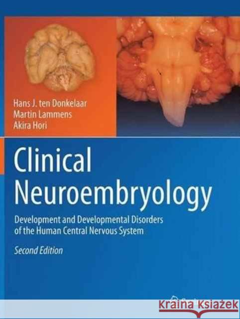 Clinical Neuroembryology: Development and Developmental Disorders of the Human Central Nervous System Ten Donkelaar, Hans J. 9783662499832