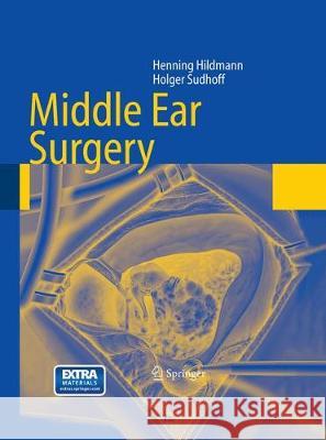 Middle Ear Surgery Henning Hildmann Holger Sudhoff 9783662499894 Springer