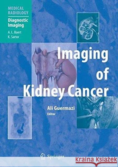 Imaging of Kidney Cancer Ali Guermazi A. L. Baert M. a. Bosniak 9783662500026 Springer