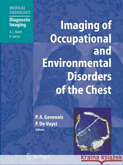 Imaging of Occupational and Environmental Disorders of the Chest Pierre Alain Gevenois Paul D 9783662500149 Springer