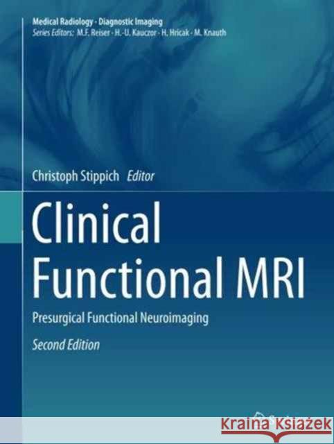 Clinical Functional MRI: Presurgical Functional Neuroimaging Stippich, Christoph 9783662500286 Springer