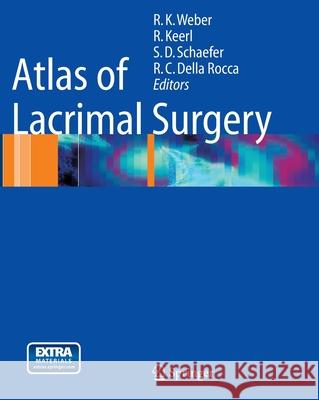 Atlas of Lacrimal Surgery Rainer K. Weber Rainer Keerl Steven D. Schaefer 9783662500347 Springer