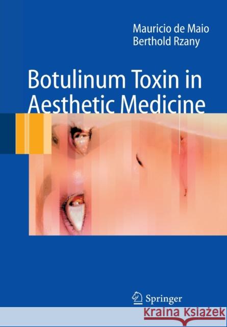 Botulinum Toxin in Aesthetic Medicine Mauricio d Berthold Rzany 9783662500682 Springer