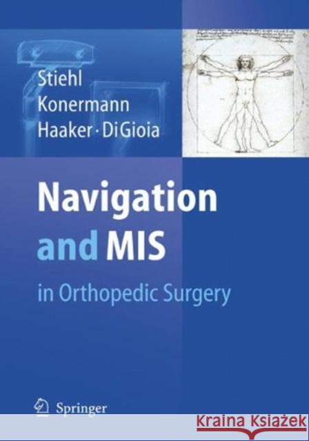 Navigation and MIS in Orthopedic Surgery James B. Stiehl Werner H. Konermann Rolf G. Haaker 9783662500729 Springer