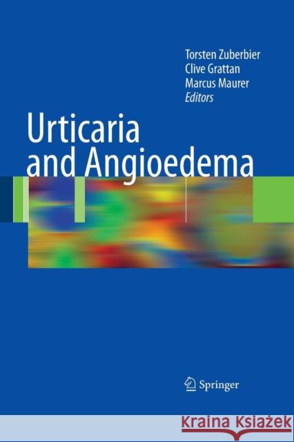 Urticaria and Angioedema Torsten Zuberbier Clive Grattan Marcus Maurer 9783662500927 Springer