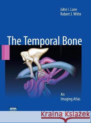 The Temporal Bone: An Imaging Atlas Lane, John I. 9783662501085 Springer