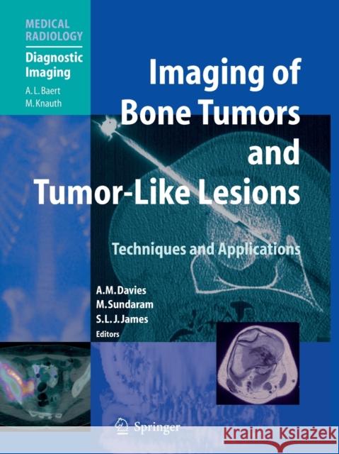 Imaging of Bone Tumors and Tumor-Like Lesions: Techniques and Applications Davies, A. Mark 9783662501634