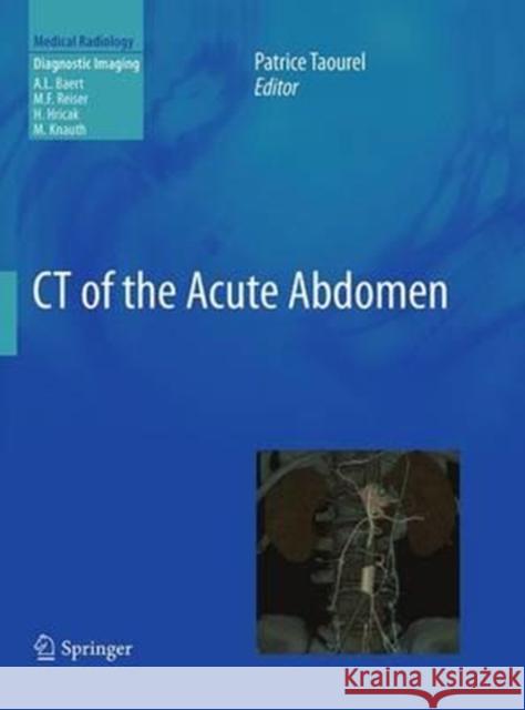 CT of the Acute Abdomen Patrice Taourel 9783662502341 Springer