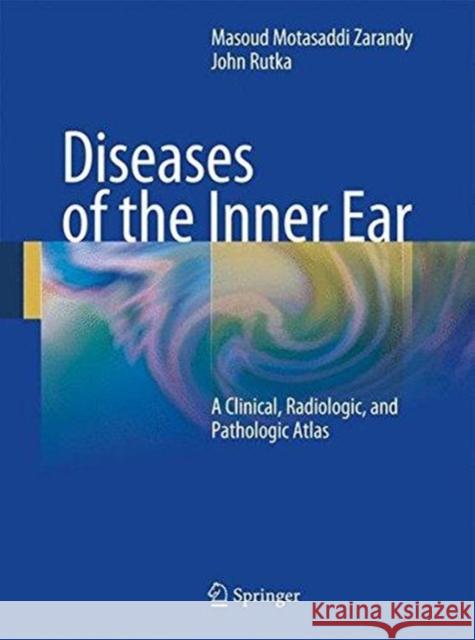 Diseases of the Inner Ear: A Clinical, Radiologic and Pathologic Atlas Motasaddi Zarandy, Masoud 9783662502488 Springer