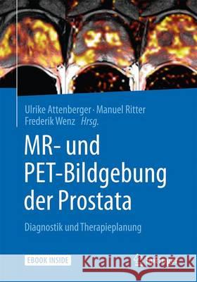 Mr- Und Pet-Bildgebung Der Prostata: Diagnostik Und Therapieplanung Attenberger, Ulrike 9783662504673 Springer
