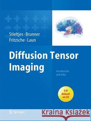 Diffusion Tensor Imaging: Introduction and Atlas Stieltjes, Bram 9783662505632 Springer