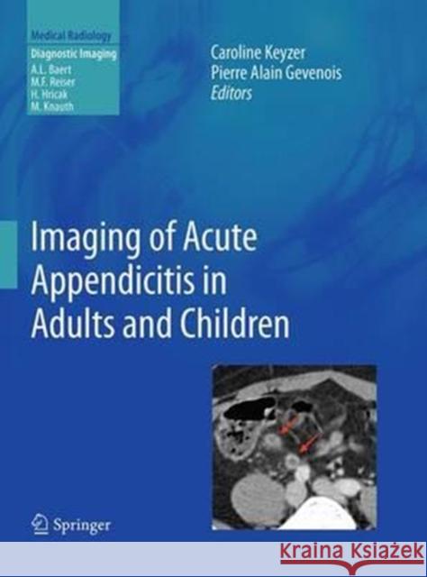 Imaging of Acute Appendicitis in Adults and Children Caroline Keyzer Pierre Alain Gevenois 9783662506370