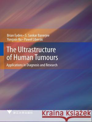 The Ultrastructure of Human Tumours: Applications in Diagnosis and Research Eyden, Brian 9783662506905