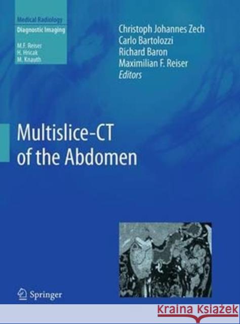 Multislice-CT of the Abdomen Christoph Johannes Zech Carlo Bartolozzi Richard Baron 9783662506967