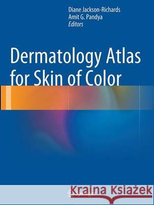 Dermatology Atlas for Skin of Color Diane Jackson-Richards Amit G. Pandya 9783662508220