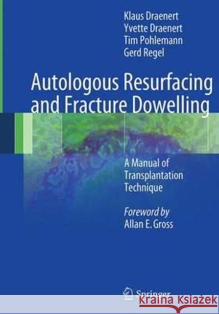 Autologous Resurfacing and Fracture Dowelling: A Manual of Transplantation Technique Draenert, Klaus 9783662508404