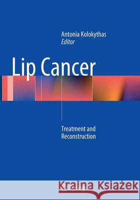 Lip Cancer: Treatment and Reconstruction Kolokythas, Antonia 9783662509326 Springer