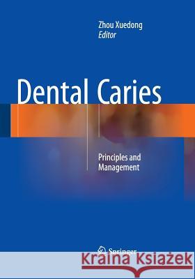 Dental Caries: Principles and Management Xuedong, Zhou 9783662510452